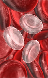 Anemia ferropénica: anemia ocasionada por falta de hierro